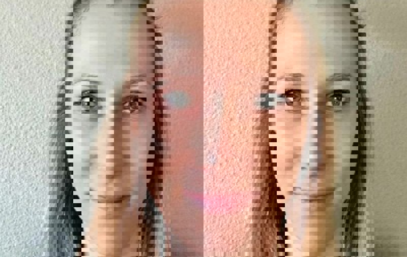 Jonge mensen met dementie en hun naasten verdienen passende zorg